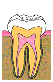 diagram abscess tooth