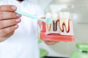 dental crown