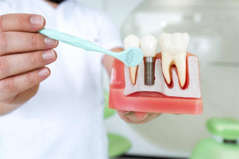 dental crown