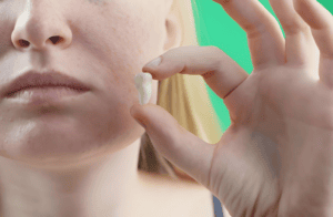 Tooth Extraction