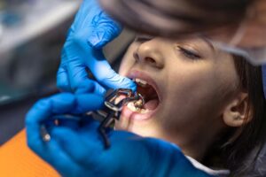 malocclusion