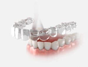 Transparent retainer fixed on lower jow. night guard