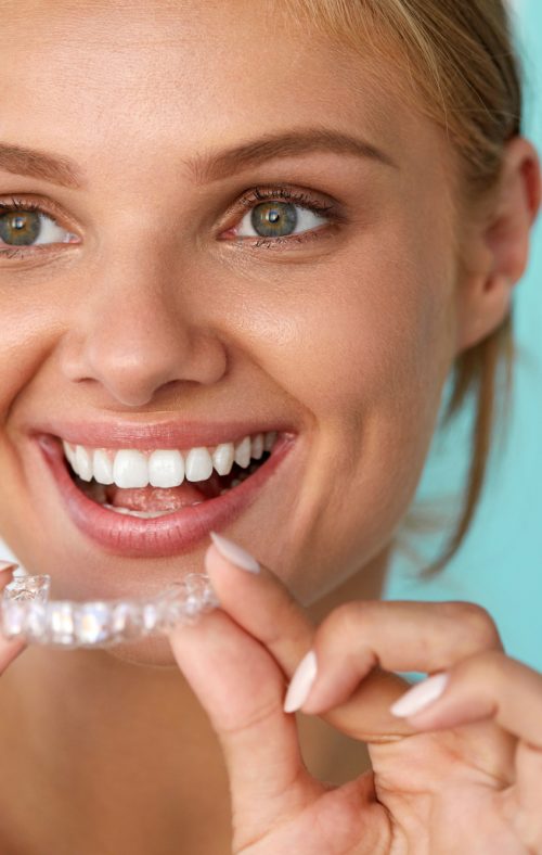 Smiling Woman With Beautiful Smile Using Teeth Whitening Tray Teeth Whitening. Beautiful Smiling Woman With White Smile, Straight Teeth Using Teeth Whitening Tray. Girl Holding Invisible Braces, Teeth Trainer. Dental Treatment Concept. High Resolution Image